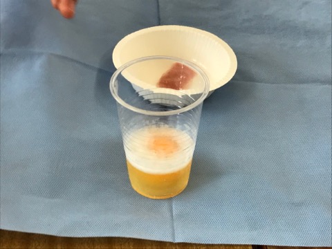 2年生卵にアルコール実験